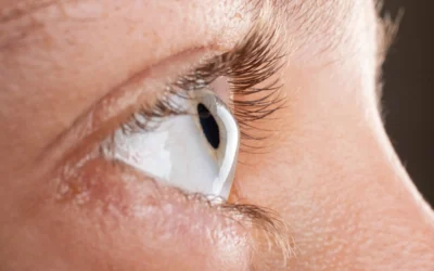 ¿Ojo Seco? Identifica los Síntomas y Consulta a Óptica Dorado